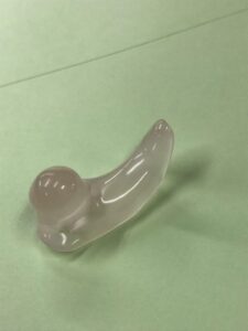 外耳道閉症で耳穴が塞がるのを防ぐ耳栓です。